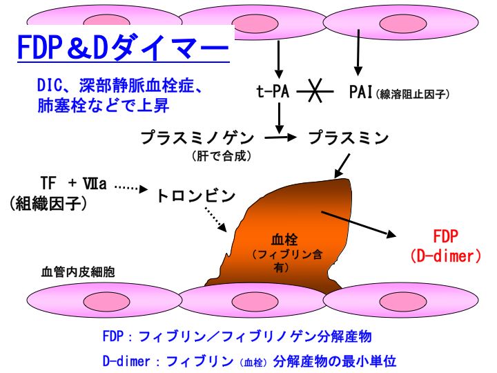 血液 検査 d ダイマー と は