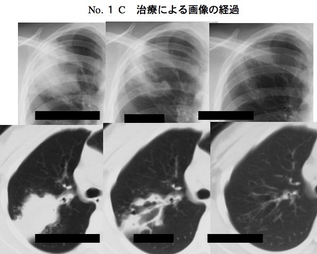 gQ1C