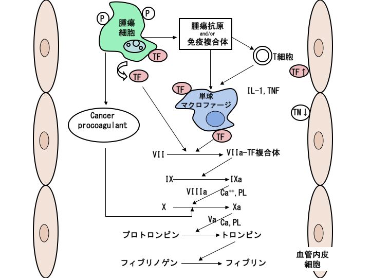 悪性 腫瘍