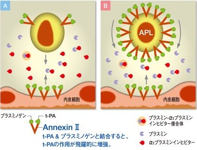 APL